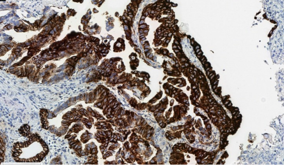 Cytoplasmic flushing due to suboptimal fixation