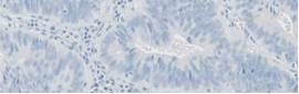Tissue sample with no staining